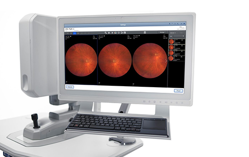 ZEISS CLARUS 500 광각 안저카메라 이미지